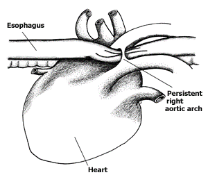 Köpekte Megaözefagus, PRAA(Persistent Right Aortic Arch) Kalıcı Sağ Aortik Kemer.